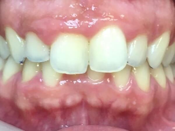 Smile Restoration Dentists Near Me